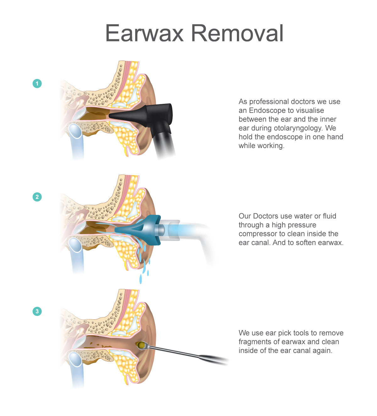 home visit for ear wax removal